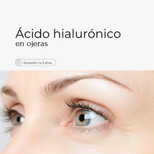 El tratamiento de ácido hialurónico en ojeras es una técnica no quirúrgica que se utiliza para rellenar y rejuvenecer el área de las ojeras. Este tratamiento emplea ácido hialurónico para hidratar y restaurar volumen en la zona, reduciendo la apariencia de las sombras y las bolsas, logrando un aspecto más descansado y juvenil.