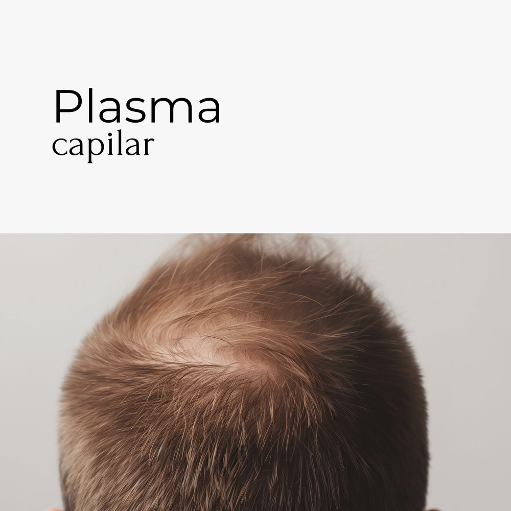 El tratamiento plasma capilar, también conocido como PRP (Plasma Rico en Plaquetas), es una técnica innovadora que utiliza la sangre del propio paciente para estimular el crecimiento capilar. A través de la extracción de una pequeña cantidad de sangre, se obtiene el plasma rico en plaquetas, que luego se inyecta en el cuero cabelludo para regenerar los folículos pilosos y promover el crecimiento de nuevos cabellos.
