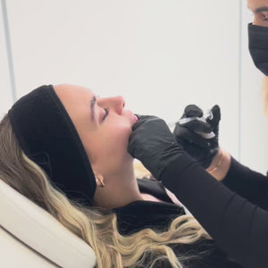 El tratamiento de ácido hialurónico en el contorno mandibular es un procedimiento estético no invasivo que utiliza ácido hialurónico para redefinir y resaltar la línea de la mandíbula. Mediante inyecciones precisas, este tratamiento mejora la definición del contorno facial, corrige flacidez y proporciona un perfil más armonioso, sin necesidad de cirugía.