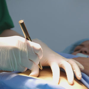 La liposucción es un procedimiento quirúrgico estético diseñado para eliminar depósitos de grasa localizada en áreas específicas del cuerpo, como abdomen, muslos, caderas o brazos, mejorando la contorno corporal. A través de pequeñas incisiones, se introduce una cánula conectada a una aspiradora para extraer la grasa de manera precisa y efectiva, dando lugar a una silueta más definida.