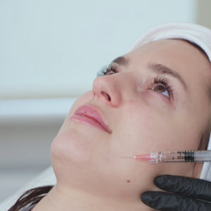 El tratamiento de armonización facial con ácido hialurónico es un procedimiento no quirúrgico que busca mejorar la simetría y el equilibrio del rostro mediante la aplicación de ácido hialurónico en áreas específicas. Este tratamiento permite resaltar y redefinir características faciales como los pómulos, la mandíbula, el contorno labial y la nariz, creando un resultado más armónico y natural.