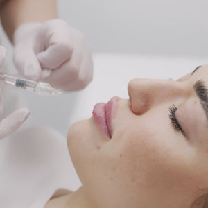 El tratamiento de ácido hialurónico en labios es un procedimiento estético no invasivo que se utiliza para aumentar el volumen, definir la forma y mejorar la hidratación de los labios. El ácido hialurónico, una sustancia natural presente en el cuerpo, se inyecta cuidadosamente en los labios para conseguir un resultado natural, suave y duradero.