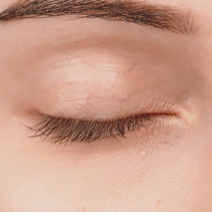 El tratamiento de ácido hialurónico en ojeras es una técnica no quirúrgica que se utiliza para rellenar y rejuvenecer el área de las ojeras. Este tratamiento emplea ácido hialurónico para hidratar y restaurar volumen en la zona, reduciendo la apariencia de las sombras y las bolsas, logrando un aspecto más descansado y juvenil.