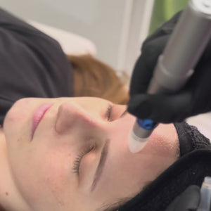 El tratamiento con exosomas es una terapia avanzada que utiliza partículas microscópicas llamadas exosomas, las cuales son liberadas por las células para promover la regeneración y reparación de los tejidos. Este tratamiento estimula la producción de colágeno y elastina, mejora la textura de la piel y acelera la recuperación celular, ideal para combatir el envejecimiento y las cicatrices.