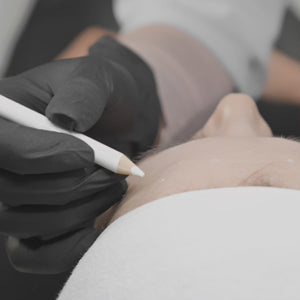 El tratamiento de Botox es un procedimiento estético no quirúrgico que utiliza toxina botulínica para relajación temporal de los músculos faciales. Al inyectarse en áreas específicas, el Botox suaviza las líneas de expresión y arrugas, como las del entrecejo, la frente y alrededor de los ojos, proporcionando un rostro más descansado y rejuvenecido.