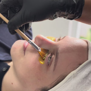 El tratamiento Quick Fade es un procedimiento estético diseñado para reducir las manchas oscuras y mejorar el tono de la piel de manera rápida y efectiva. Utilizando ingredientes activos y tecnología avanzada, este tratamiento actúa sobre la hiperpigmentación, aclarando la piel y dejándola con una apariencia más uniforme y luminosa.