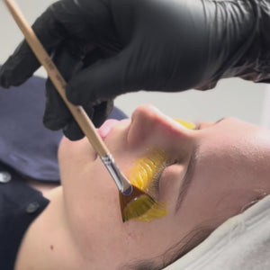 El tratamiento Quick Fade es un procedimiento estético diseñado para reducir las manchas oscuras y mejorar el tono de la piel de manera rápida y efectiva. Utilizando ingredientes activos y tecnología avanzada, este tratamiento actúa sobre la hiperpigmentación, aclarando la piel y dejándola con una apariencia más uniforme y luminosa.