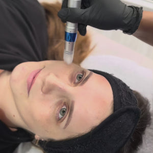 El tratamiento con exosomas es una terapia avanzada que utiliza partículas microscópicas llamadas exosomas, las cuales son liberadas por las células para promover la regeneración y reparación de los tejidos. Este tratamiento estimula la producción de colágeno y elastina, mejora la textura de la piel y acelera la recuperación celular, ideal para combatir el envejecimiento y las cicatrices.