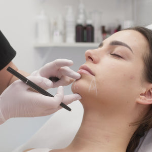 Ácido hialurónico en mentón