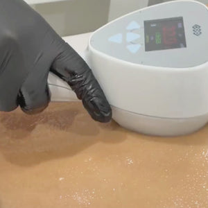El tratamiento Exilis es una tecnología no invasiva que combina radiofrecuencia y ultrasonido para reducir la grasa localizada y mejorar la firmeza de la piel. Utilizando energía controlada, Exilis estimula la producción de colágeno y elastina, lo que ayuda a reafirmar el contorno corporal y facial de manera efectiva y sin cirugía.