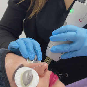 El láser de manchas Alexandrita es un tratamiento estético utilizado para eliminar manchas y pigmentaciones en la piel. Este láser utiliza una longitud de onda específica (755 nm) que es eficaz para tratar diversas afecciones pigmentarias, como manchas solares, melasma y lentigos, al desintegrar la melanina sin dañar la piel circundante.